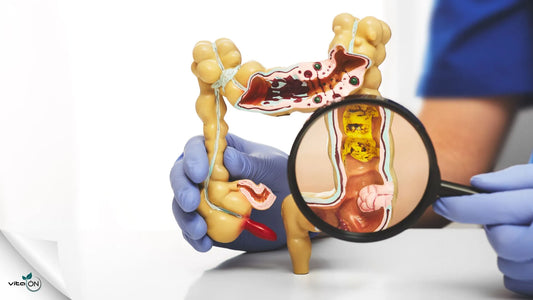 ¿Cuál es el mejor probiótico para el colon?